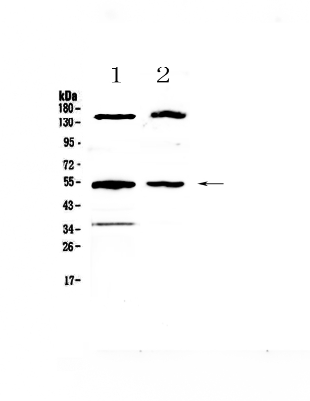 1 - Anti-Glucokinase Picoband Antibody ABO12897
