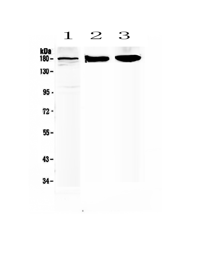 1 - Anti-SUR1 Picoband Antibody ABO12898