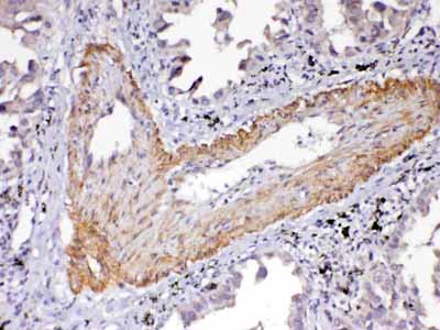 2 - Anti-VEGF Receptor 2 Picoband Antibody ABO12899