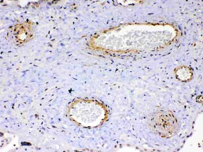 2 - Anti-VEGF Receptor 2 Picoband Antibody ABO12899