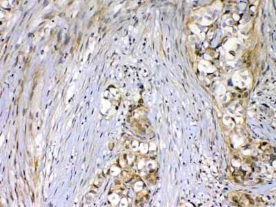 2 - Anti-VEGF Receptor 2 Picoband Antibody ABO12899
