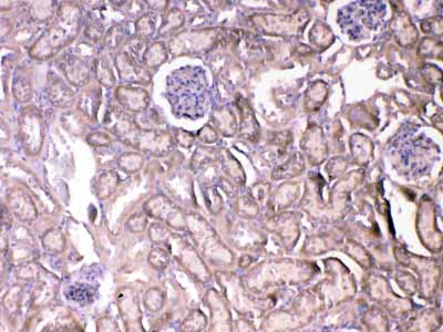 2 - Anti-VEGF Receptor 2 Picoband Antibody ABO12900