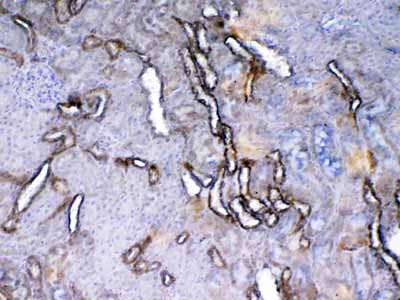 2 - Anti-VEGF Receptor 2 Picoband Antibody ABO12900