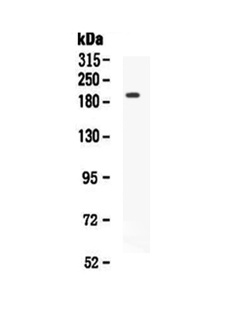 1 - Anti-VEGF Receptor 2 Picoband Antibody ABO12900
