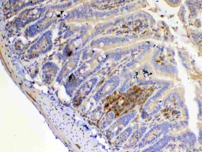 2 - Anti-IL12A Picoband Antibody ABO12902