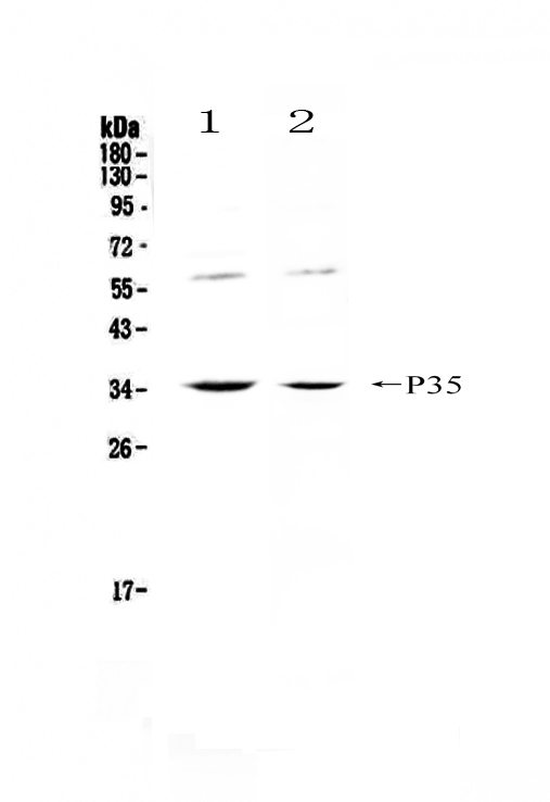 1 - Anti-IL12A Picoband Antibody ABO12902