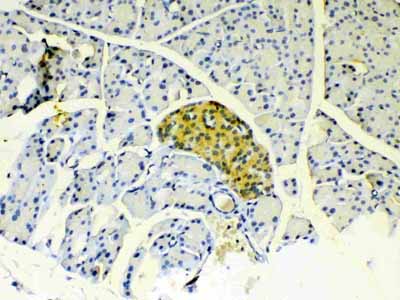 2 - Anti-IGFBP1 Picoband Antibody ABO12903