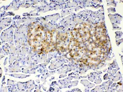 2 - Anti-IGFBP1 Picoband Antibody ABO12903