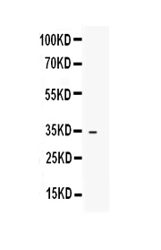 1 - Anti-IGFBP1 Picoband Antibody ABO12903