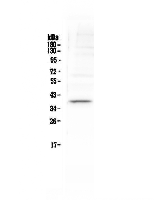 1 - Anti-Tal1 Picoband Antibody ABO12904