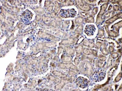 2 - Anti-PNP Picoband Antibody ABO12910