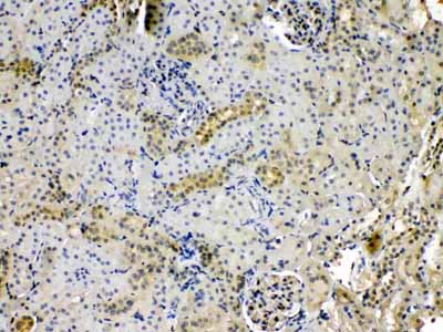 2 - Anti-PNP Picoband Antibody ABO12910
