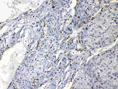2 - Anti-PNP Picoband Antibody ABO12910