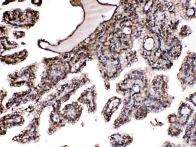 2 - Anti-PNP Picoband Antibody ABO12910