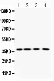 1 - Anti-PNP Picoband Antibody ABO12910