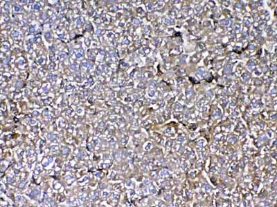2 - Anti-MBL2 Picoband Antibody ABO12912