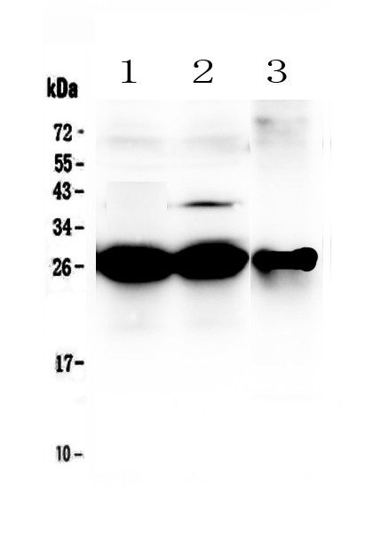 1 - Anti-MBL2 Picoband Antibody ABO12912