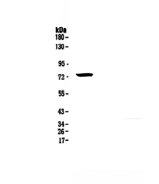 1 - Anti-IRAK Picoband Antibody ABO12914