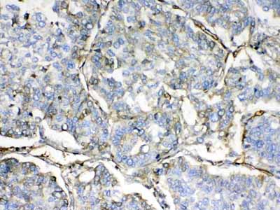 2 - Anti-HBD Picoband Antibody ABO12915