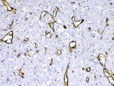 2 - Anti-HBD Picoband Antibody ABO12915