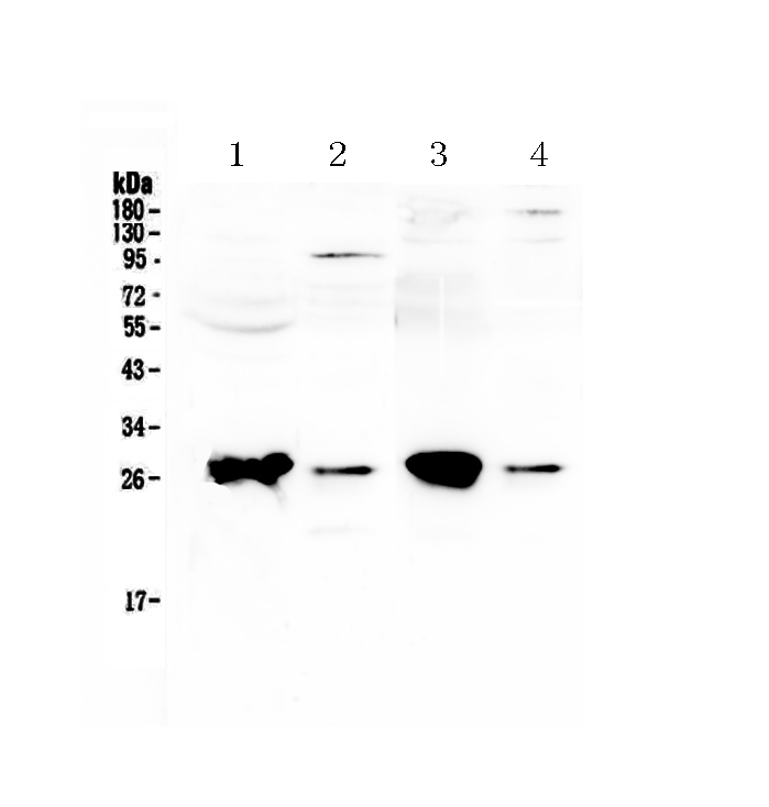 1 - Anti-GSTT1 Picoband Antibody ABO12916