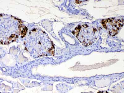 2 - Anti-RBP4 Picoband Antibody ABO12917