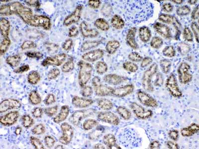 2 - Anti-RBP4 Picoband Antibody ABO12917