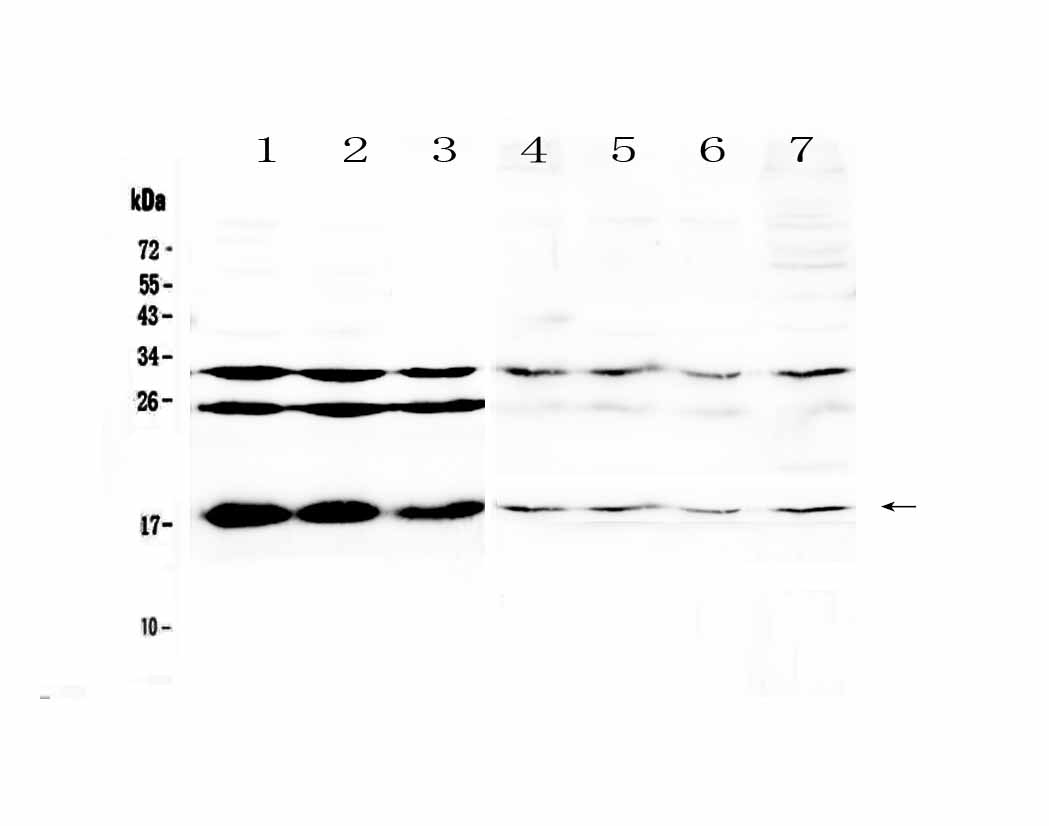 1 - Anti-TSLP Picoband Antibody ABO12920