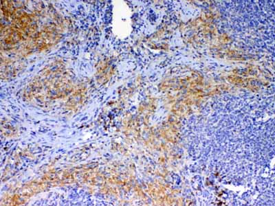 2 - Anti-CD40L Picoband Antibody ABO12924