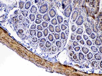 2 - Anti-Factor D Picoband Antibody ABO12925