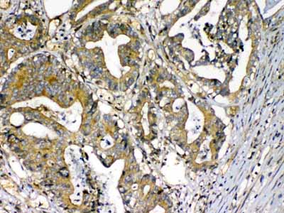 2 - Anti-Factor D Picoband Antibody ABO12925
