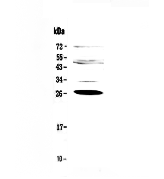 1 - Anti-Factor D Picoband Antibody ABO12925