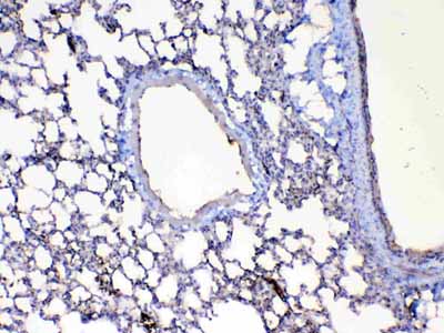 2 - Anti-Factor D Picoband Antibody ABO12926
