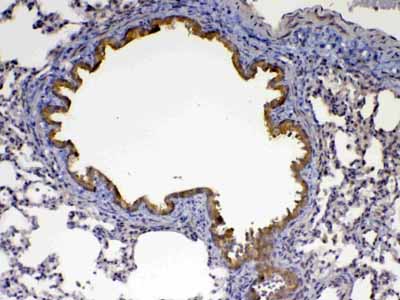 2 - Anti-Factor D Picoband Antibody ABO12926