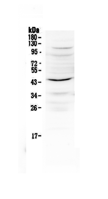 1 - Anti-IL12B Picoband Antibody ABO12927