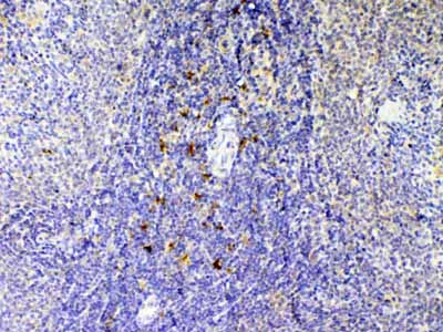 2 - Anti-IL12B Picoband Antibody ABO12928