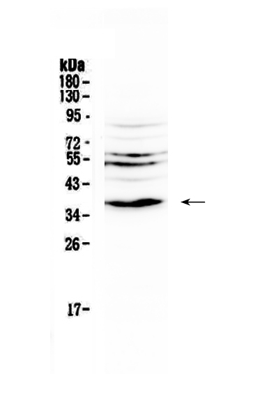 1 - Anti-IL12B Picoband Antibody ABO12928