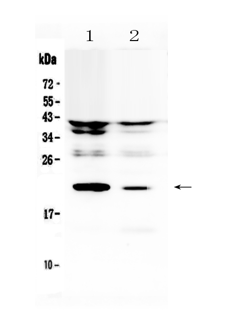 1 - Anti-IL11 Picoband Antibody ABO12930