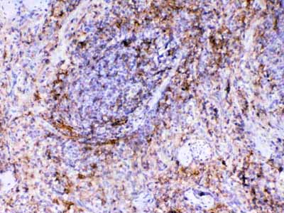 2 - Anti-VCAM1 Picoband Antibody ABO12933