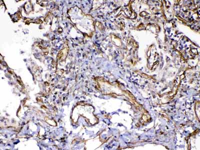 2 - Anti-VEGF Receptor 3 Picoband Antibody ABO12936