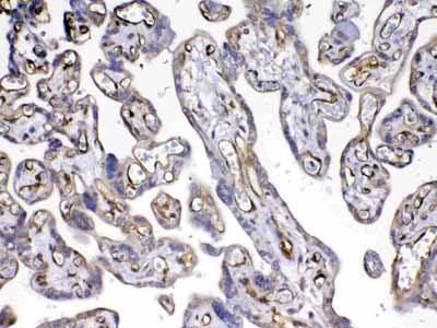 2 - Anti-VEGF Receptor 3 Picoband Antibody ABO12936