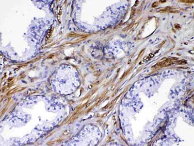 2 - Anti-VEGF Receptor 3 Picoband Antibody ABO12936