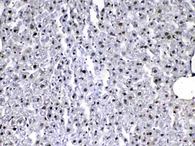 2 - Anti-VEGF Receptor 3 Picoband Antibody ABO12936