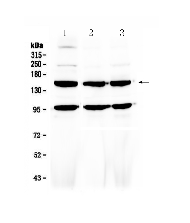 1 - Anti-VEGF Receptor 3 Picoband Antibody ABO12936