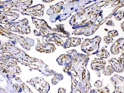 2 - Anti-VEGF Receptor 3 Picoband Antibody ABO12937