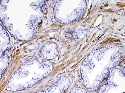 2 - Anti-VEGF Receptor 3 Picoband Antibody ABO12937