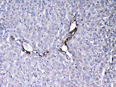 2 - Anti-VEGF Receptor 3 Picoband Antibody ABO12937