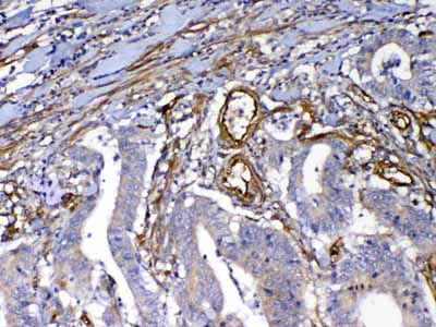 2 - Anti-VEGF Receptor 3 Picoband Antibody ABO12937