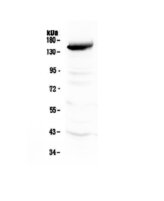1 - Anti-VEGF Receptor 3 Picoband Antibody ABO12937