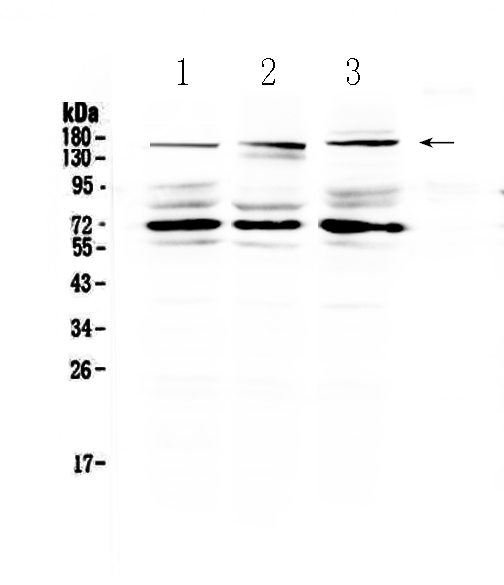1 - Anti-IL17RA Antibody ABO12939